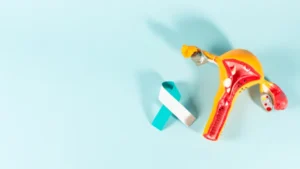 Penyebab Kanker Ovarium pada Anak: Apa yang Perlu Diketahui?